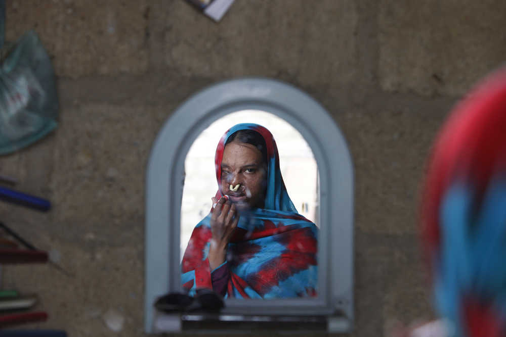 In this photo taken on Jan. 27, Pakistani acid victim Sidra Kamwal looks herself in a mirror in Karachi, Pakistan. Sidra's attacker is in jail, but his family has been embraced by the neighbors. The family jeers at her, and the neighbors applaud. Sidra, with her painfully disfigured face, is the outcast.