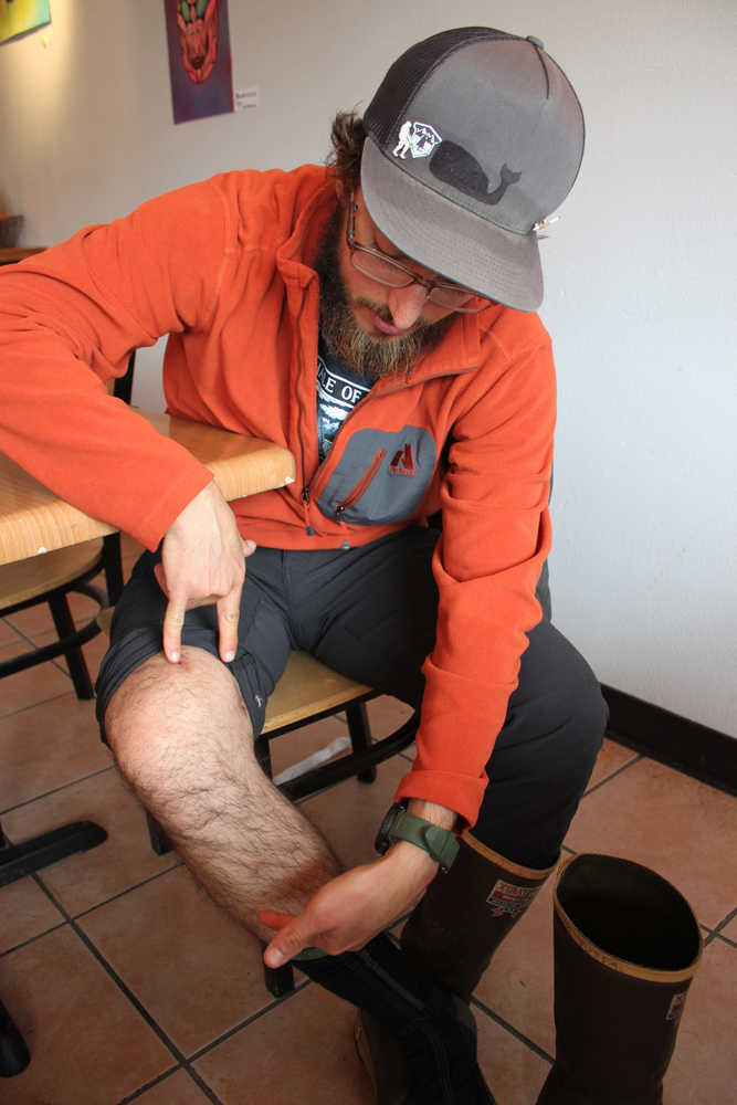 UnCruise Adventures guide Michael Justa shows where he was bit by a bear Aug. 22 while hiking with a group of 22 guests near Sitka. The distance between the three areas on his right leg where he got stitches shows the extent of how big the bear's mouth was during the bite.