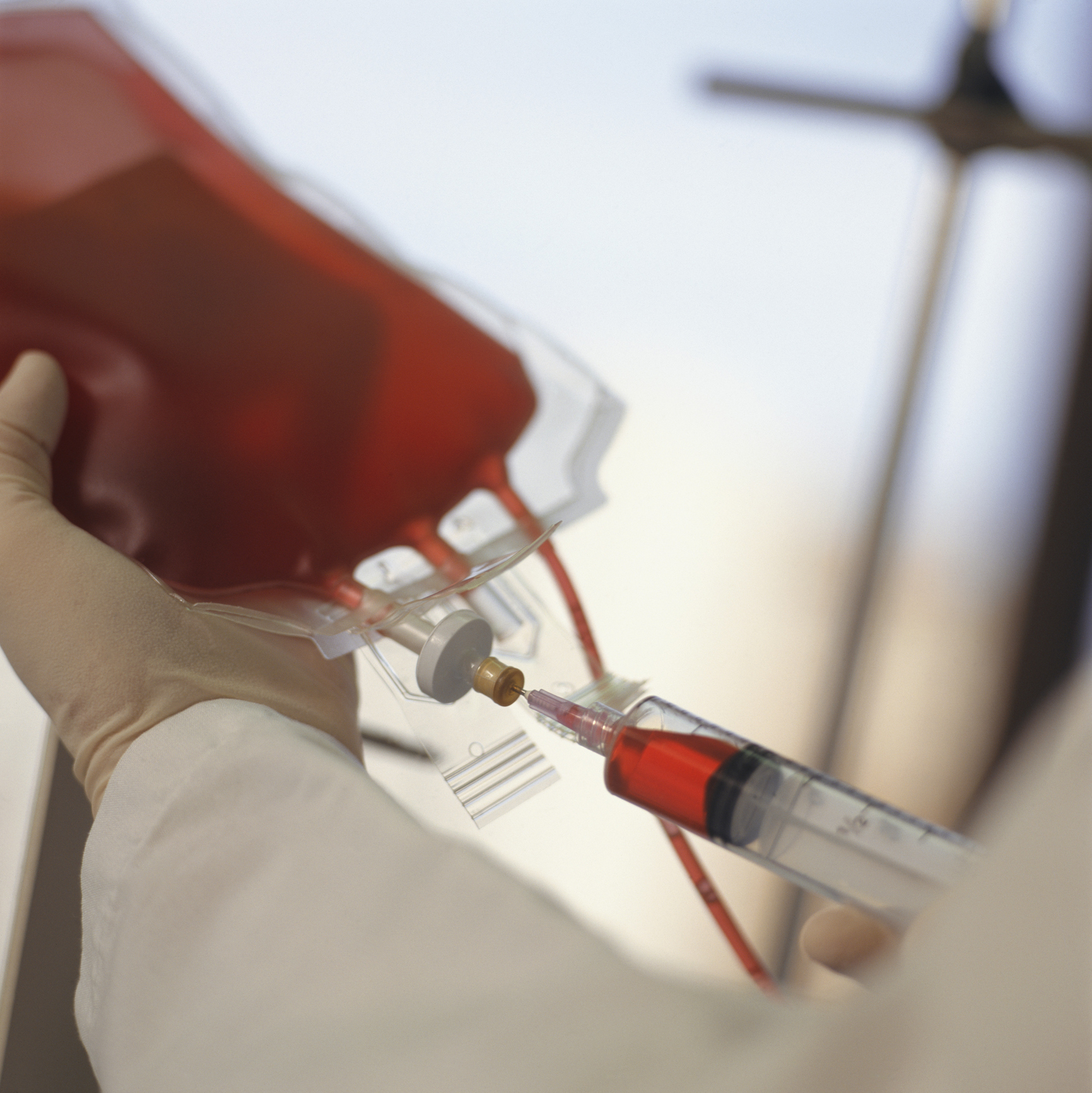 A technician draws blood with a syringe from a blood bag