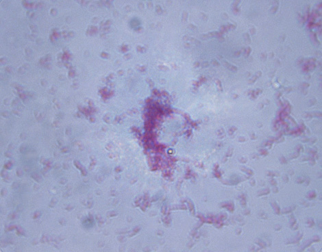 Microscopic Image of Salmonella Typhi