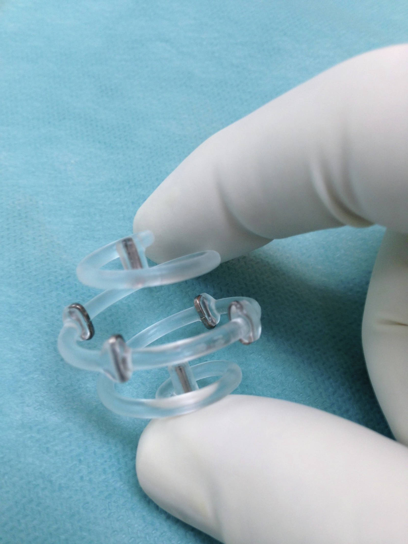 Photo courtesy of BioZorb Dr. Karen Barbosa, a Breast Fellowship-trained surgeon in Anchorage, has begun using BioZorb in lumpectomies. After a lump is removed, the surgeon inserts the device, a spiral the size of a walnut and six little titanium clips, that is implanted in the area where the lump was removed. It acts as a scaffold for reconstructive surgery and reduces the amount of radiation needed during treatment.