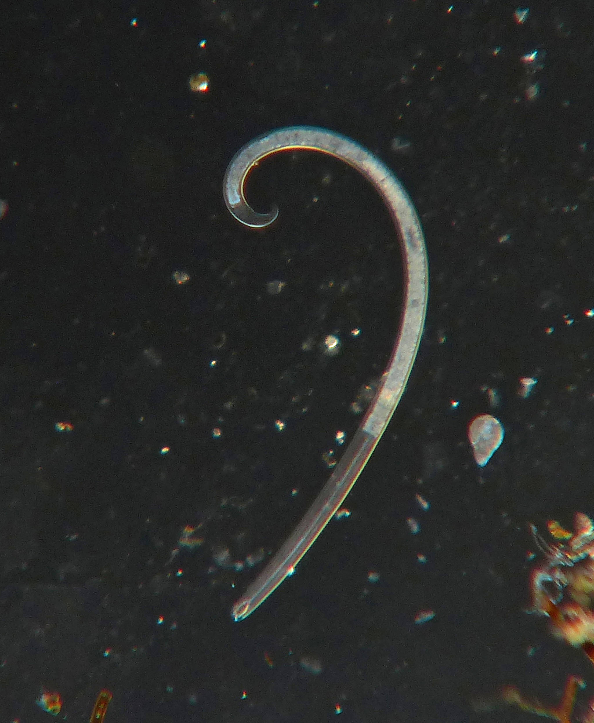 A typical nematode or round worm, as seen under a microscope. (Courtesy photo | Bob Armstrong)