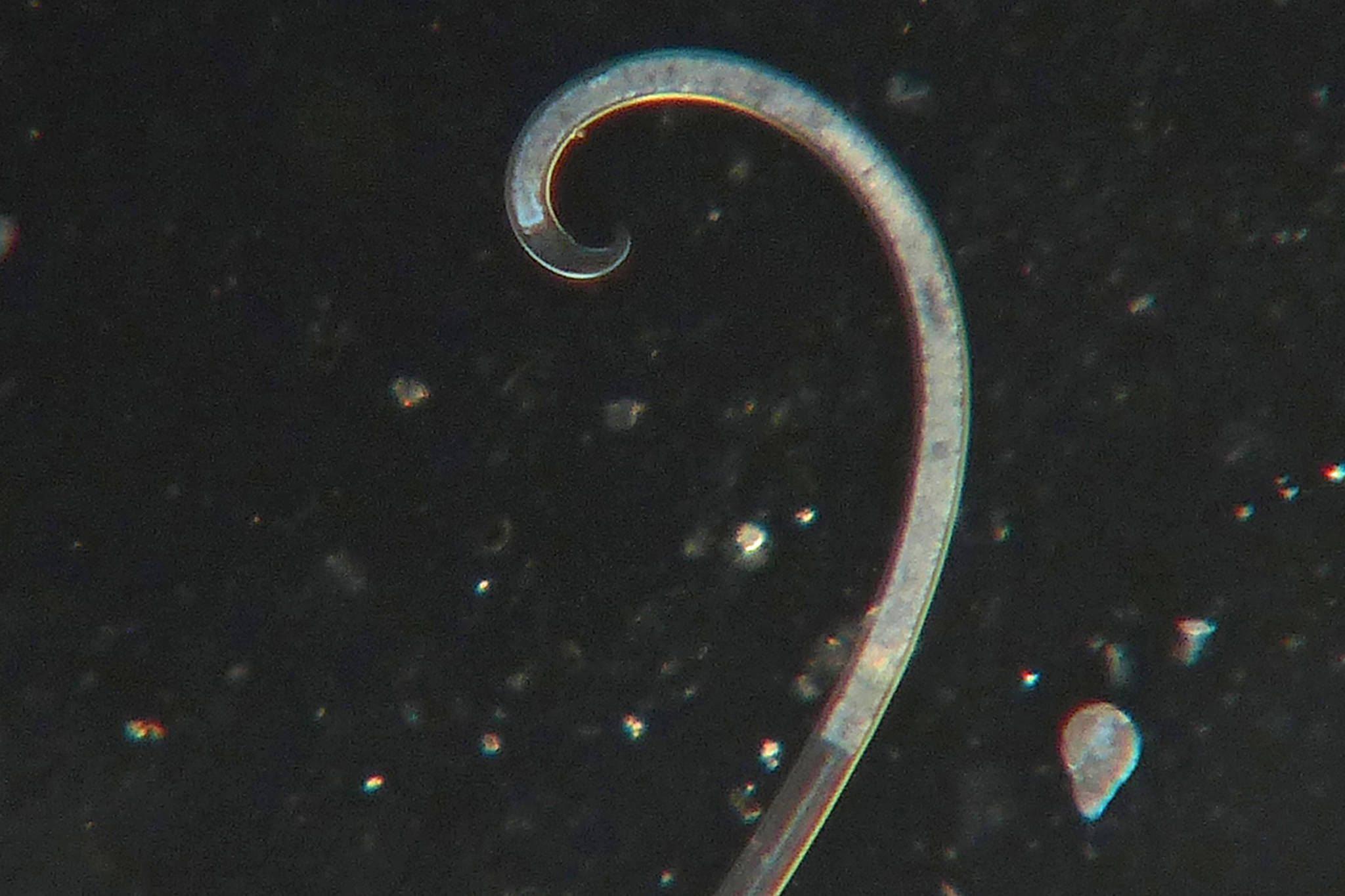 The story behind these ubiquitous round worms