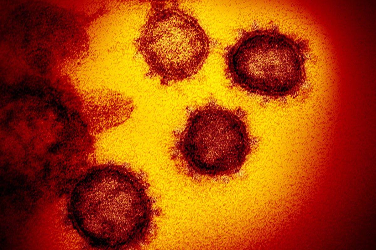 This undated electron microscope image made available by the U.S. National Institutes of Health in February 2020 shows the Novel Coronavirus SARS-CoV-2. Also known as 2019-nCoV, the virus causes COVID-19.. (NIAID-RML via AP)
