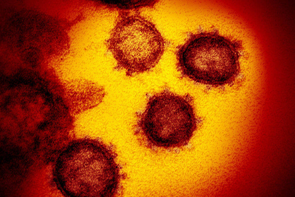This undated electron microscope image made available by the U.S. National Institutes of Health in February 2020 shows the Novel Coronavirus SARS-CoV-2. Also known as 2019-nCoV, the virus causes COVID-19. The sample was isolated from a patient in the U.S. (NIAID-RML)