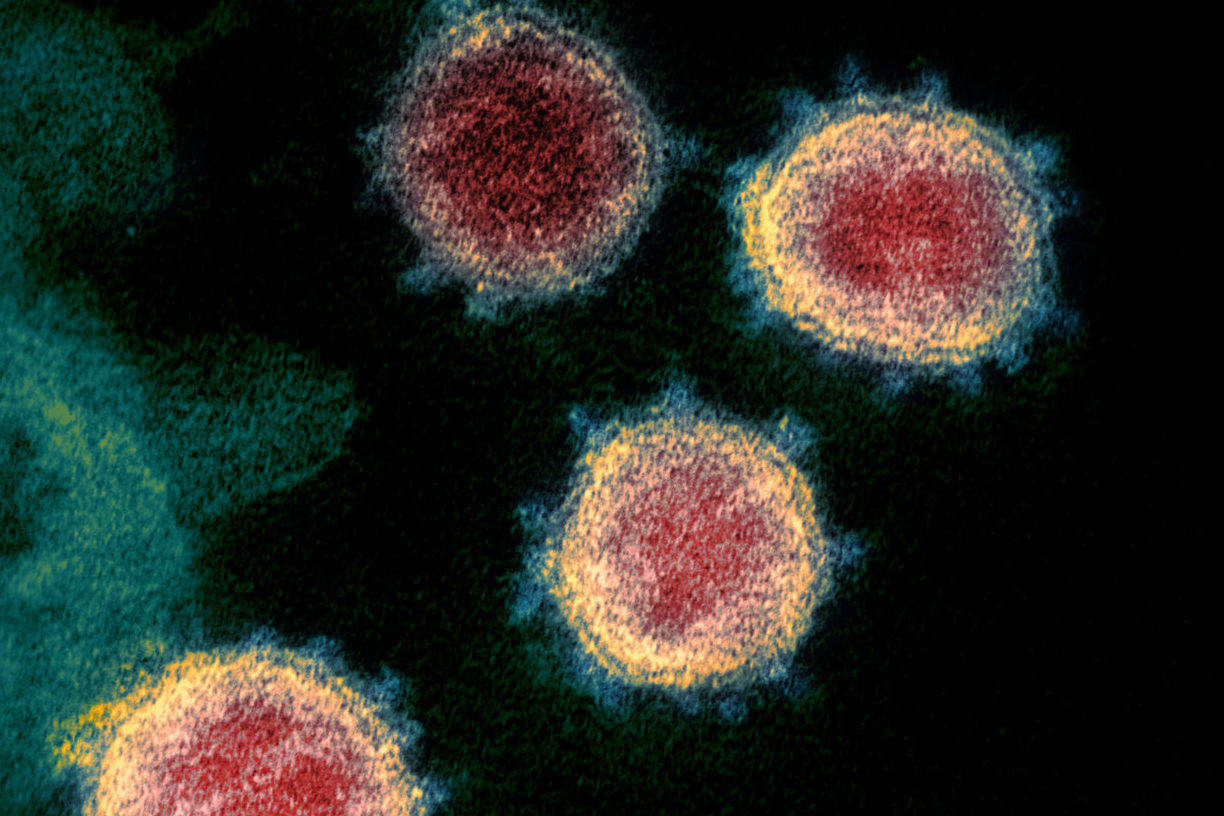 This undated electron microscope image made available by the U.S. National Institutes of Health in February 2020 shows the coronavirus that causes COVID-19. The sample was isolated from a patient in the U.S. (NIAID-RML via AP)