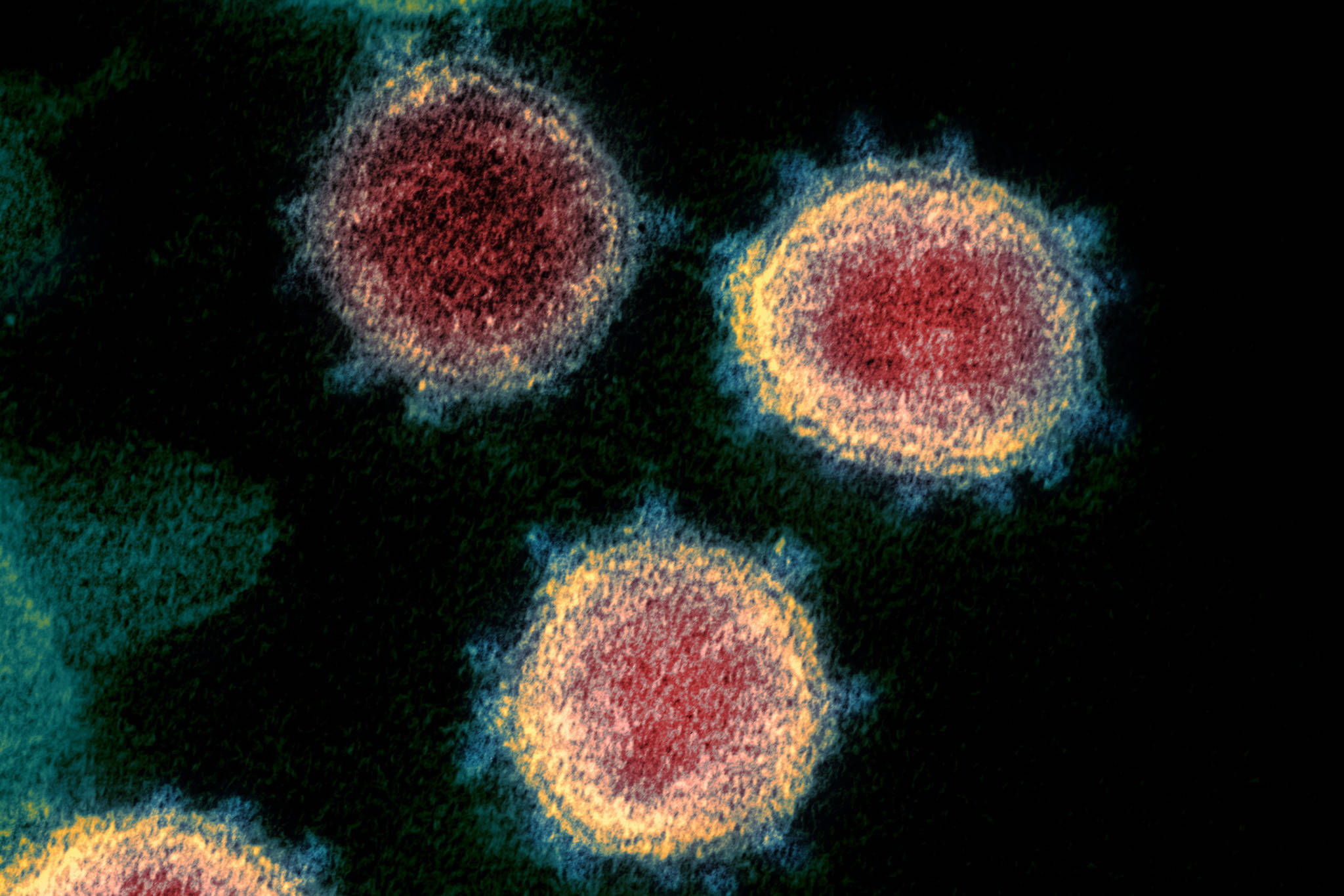This undated electron microscope image made available by the U.S. National Institutes of Health in February 2020 shows the coronavirus that causes COVID-19. The sample was isolated from a patient in the U.S. (NIAID-RML via AP)