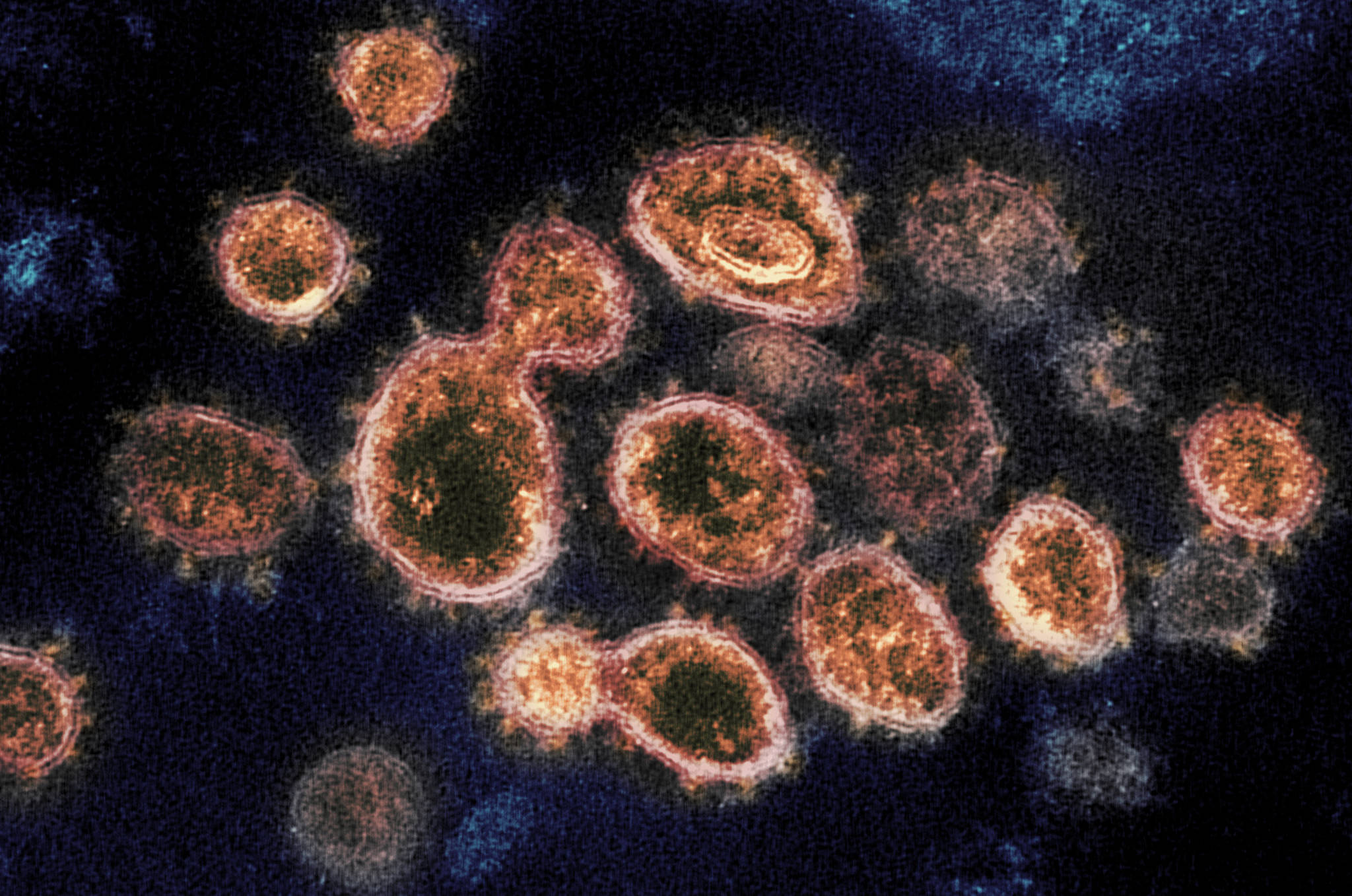 This 2020 electron microscope image provided by the National Institute of Allergy and Infectious Diseases - Rocky Mountain Laboratories shows SARS-CoV-2 virus particles which causes COVID-19, isolated from a patient in the U.S., emerging from the surface of cells cultured in a lab. (NIAID-RML via AP)