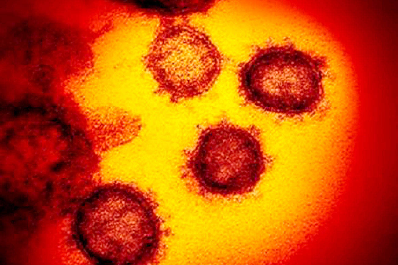 This transmission electron microscope image shows SARS-CoV-2, the virus that causes COVID-19, isolated from a patient in the U.S., emerging from the surface of cells cultured in the lab. (NIAID/TNS)
