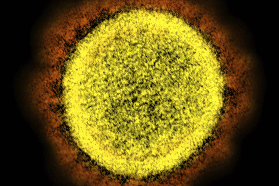 This 2020 electron microscope image made available by the National Institute of Allergy and Infectious Diseases shows a Novel Coronavirus SARS-CoV-2 particle isolated from a patient, in a laboratory in Fort Detrick, Md. Coronaviruses, including the newest one, are named for the spikes that cover their outer surface like a crown, or corona in Latin. Using those club-shaped spikes, the virus latches on to the outer wall of a human cell, invades it and replicates, creating viruses to hijack more cells. (NIAID/NIH via AP)