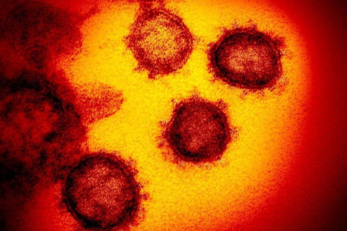 Electron microscope image of SARS-CoV-2, the virus that causes COVID-19, released by the U.S. National Institutes of Health in February 2020. (Associated Press)