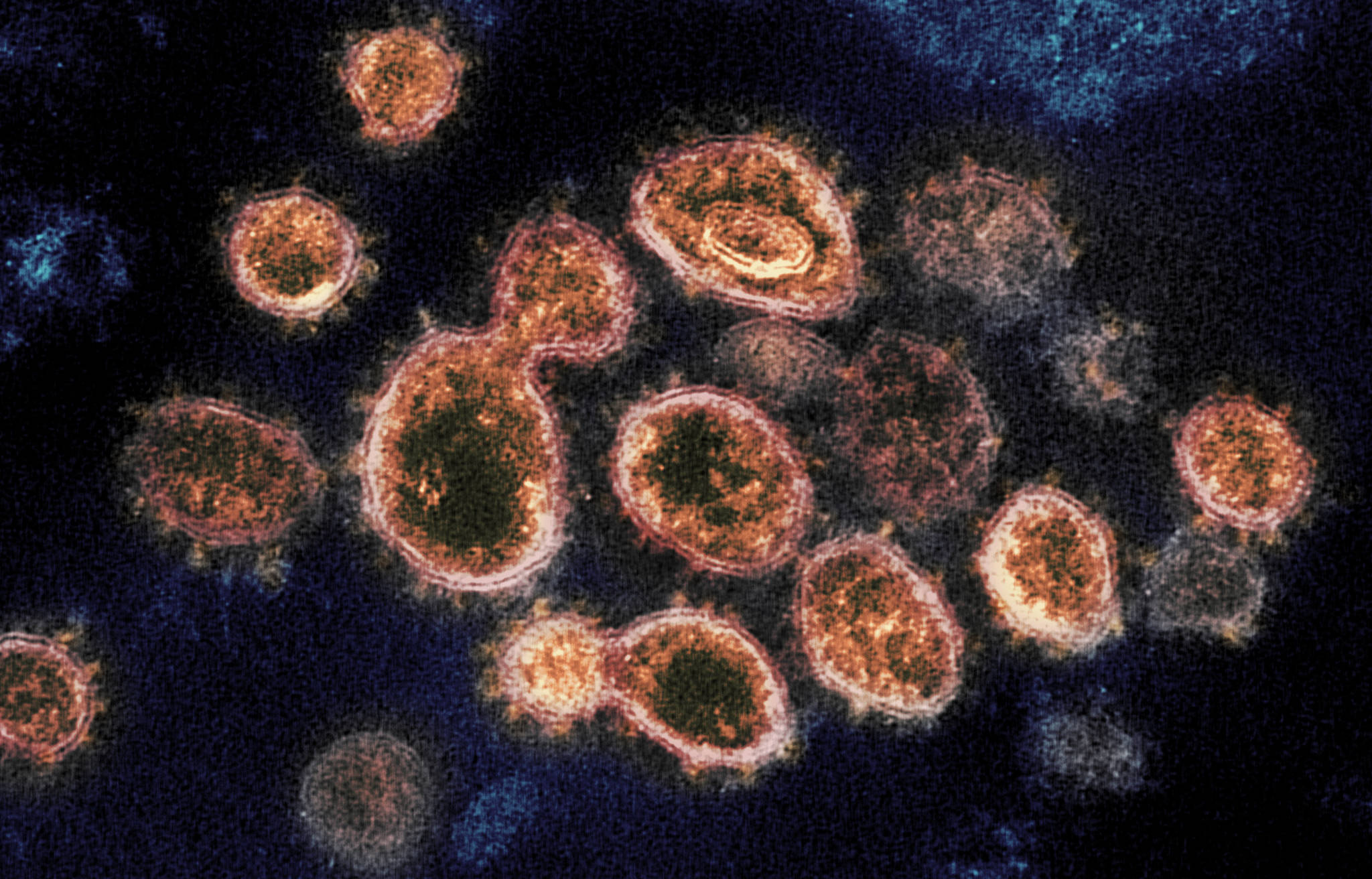 This image provided by National Institute of Allergy and Infectious Diseases - Rocky Mountain Laboratories shows SARS-CoV-2 virus particles which causes COVID-19, isolated from a patient in the U.S., emerging from the surface of cells cultured in a lab. (NIAID-RML via AP)