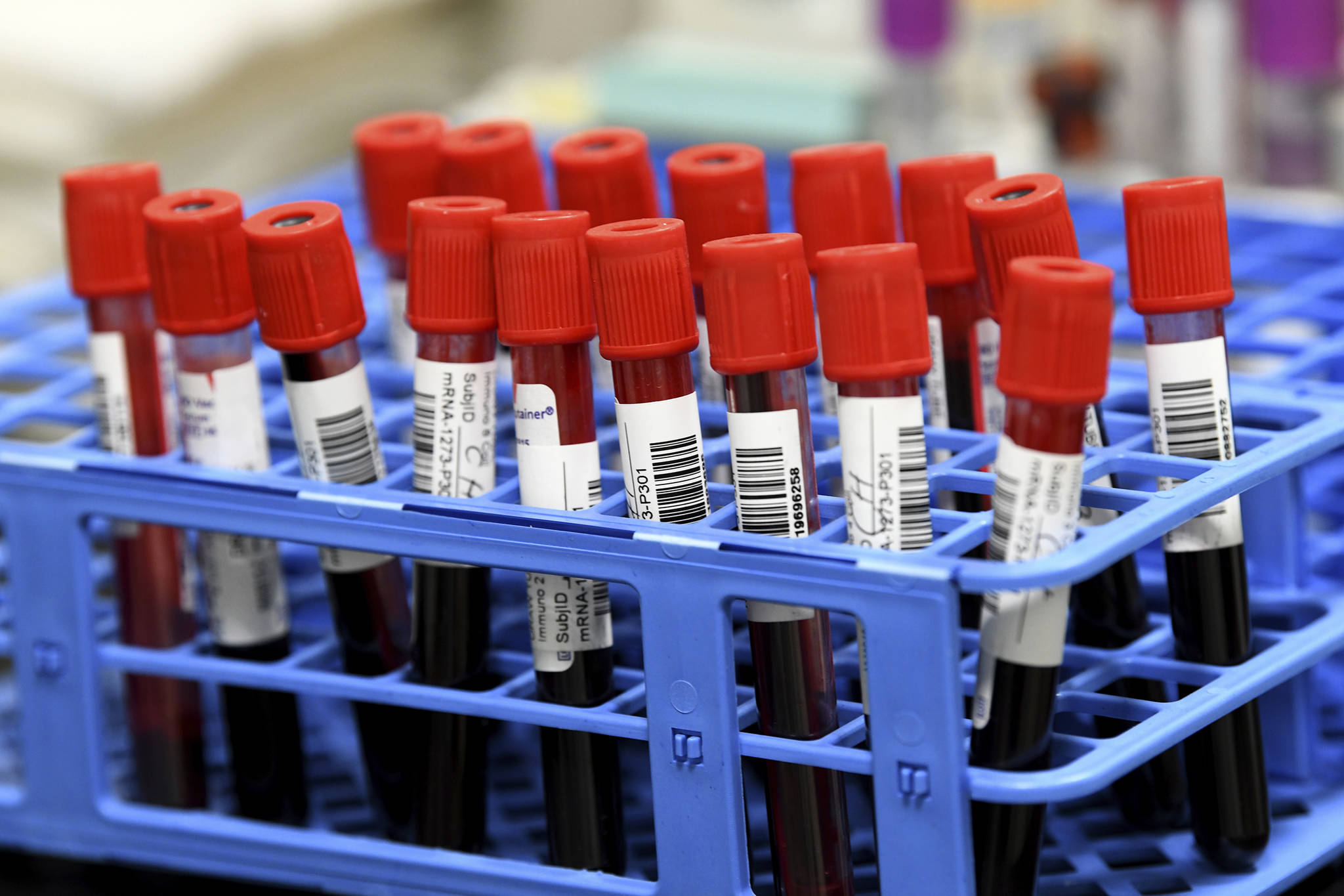 This photo shows blood samples from volunteers participating in the last-stage testing of the COVID-19 vaccine by Moderna and the National Institutes wait to be processed in a lab at the University of Miami Miller School of Medicine in Miami. Creating vaccines and properly testing them less than a year after the world discovered a never-before-seen disease is incredible. But the two U.S. frontrunners are made in a way that promises speedier development may become the norm — especially if they prove to work long-term as well as they have in early testing. (AP Photo/Taimy Alvarez, File)