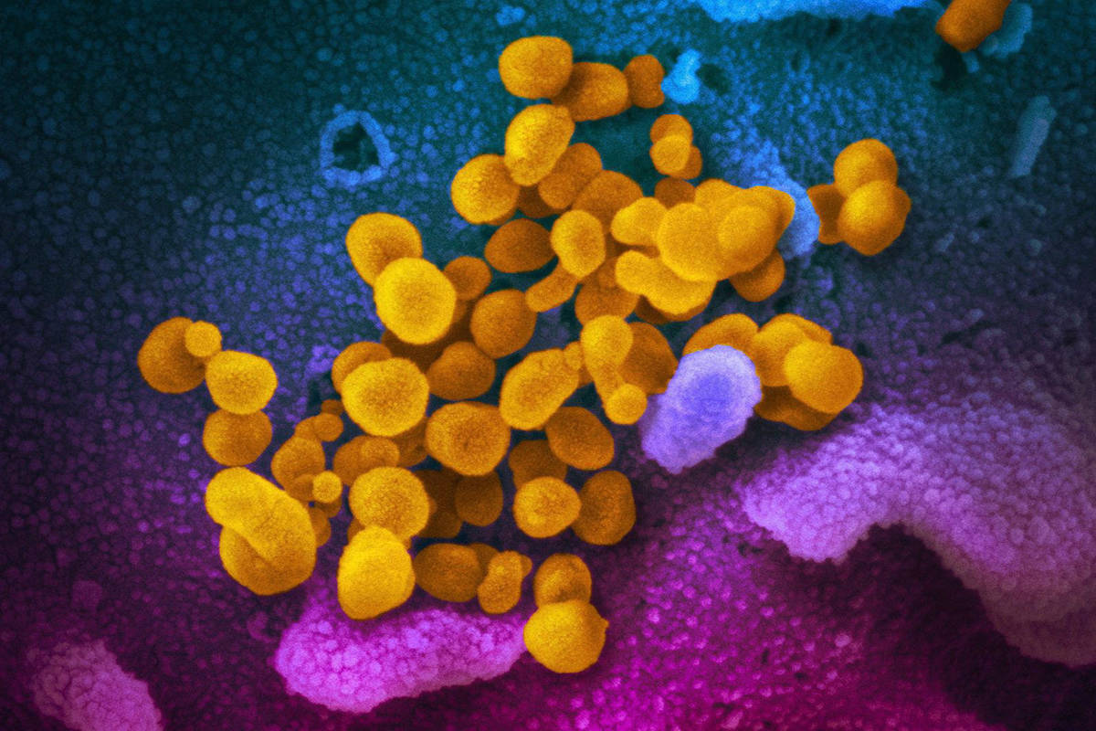 This undated electron microscope image made available by the U.S. National Institutes of Health in February 2020 shows the Novel Coronavirus SARS-CoV-2, yellow, emerging from the surface of cells, blue/pink, cultured in the lab. Also known as 2019-nCoV, the virus causes COVID-19. (Photo by the Canadian Press/AP-NIAID-RML via AP)