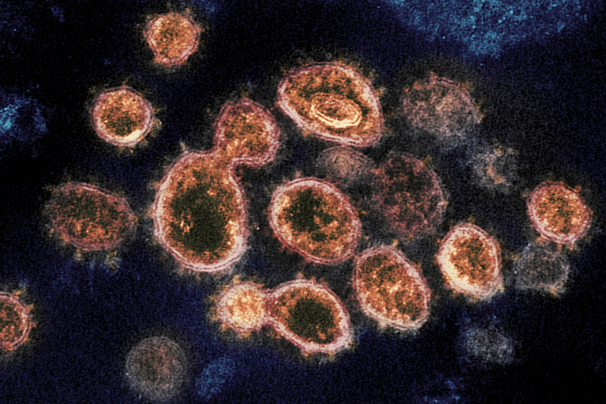 FILE - This 2020 electron microscope image provided by the National Institute of Allergy and Infectious Diseases - Rocky Mountain Laboratories shows SARS-CoV-2 virus particles which cause COVID-19, isolated from a patient in the U.S., emerging from the surface of cells cultured in a lab. Viruses are constantly mutating, with coronavirus variants circulating around the globe. (NIAID-RML via AP)
