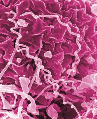 This image shows treponema pallidum, the bacteria that cause syphilis. Alaska’s syphilis infection rates increased by 49% over 2019 numbers, the Department of Health and Social Services reported this week. (Courtesy Photo / NIAID)