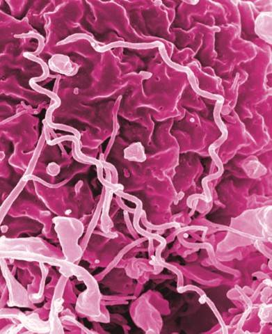 This image shows treponema pallidum, the bacteria that cause syphilis. Alaskas syphilis infection rates increased by 49% over 2019 numbers, the Department of Health and Social Services reported this week. (Courtesy Photo / NIAID)