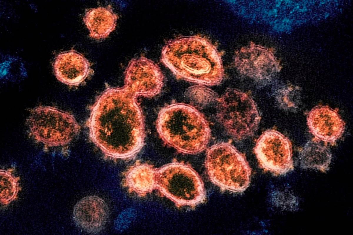 This 2020 electron microscope image provided by the National Institute of Allergy and Infectious Diseases - Rocky Mountain Laboratories shows SARS-CoV-2 virus particles which cause COVID-19, isolated from a patient in the U.S., emerging from the surface of cells cultured in a lab. nbsp; (NIAID-RML via AP)