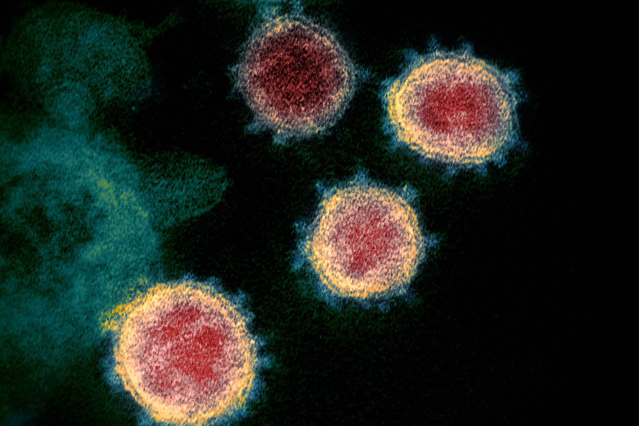 This undated electron microscope image made available by the U.S. National Institutes of Health in February 2020 shows the virus that causes COVID-19. Monoclonal antibodies may be a good treatment option for some people who test positive for the illness, according to state health officials. However, vaccination remains the best tool for limiting spread of COVID-19 and limiting hospitalizations. (NIAID-RML via AP, File)