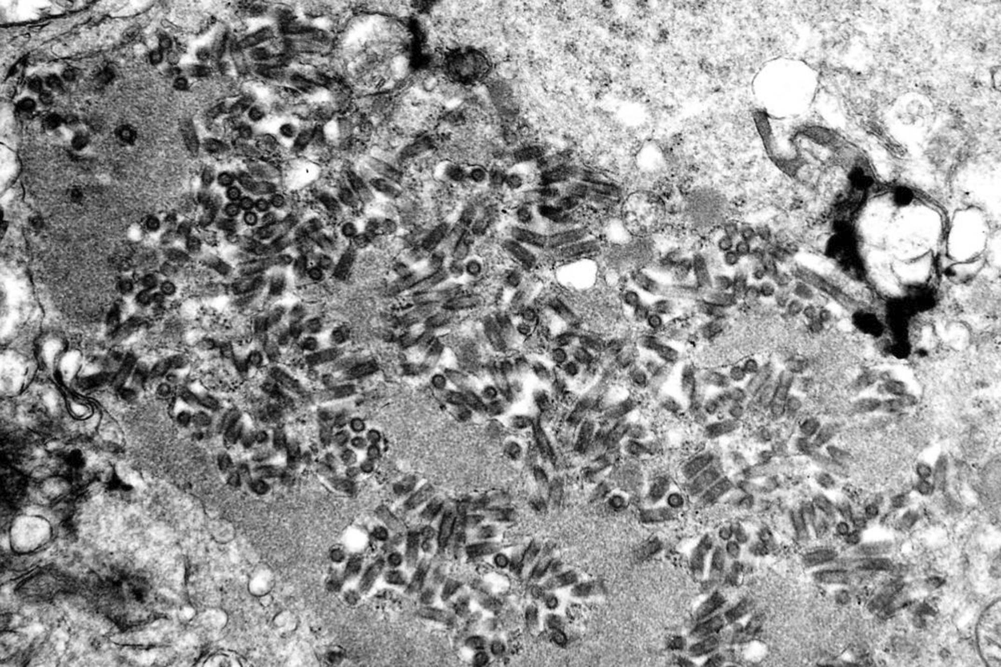 This undated electron microscope image made available by the Centers for Disease Control and Prevention shows rabies virions, dark and bullet-shaped, within an infected tissue sample. (F. A. Murphy/CDC via AP)