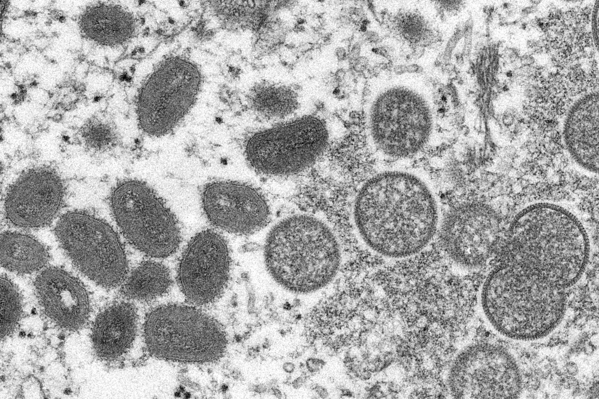 Cynthia S. Goldsmith, Russell Regner / CDC 
This 2003 electron microscope image made available by the Centers for Disease Control and Prevention shows mature, oval-shaped monkeypox virions, left, and spherical immature virions, right, obtained from a sample of human skin associated with the 2003 prairie dog outbreak. Alaska reported on Friday its first case of monkeypox.