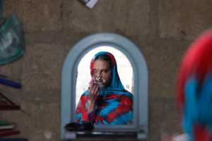 In this photo taken on Jan. 27, Pakistani acid victim Sidra Kamwal looks herself in a mirror in Karachi, Pakistan. Sidra's attacker is in jail, but his family has been embraced by the neighbors. The family jeers at her, and the neighbors applaud. Sidra, with her painfully disfigured face, is the outcast.