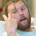 Josh Dybdahl, 30, of Hoonah, talks at Bartlett Regional Hospital on Tuesday of being attacked by a bear. Dybdahl was being mauled when his friend, Anthony Lindoff, 36, shot and killed the bear.