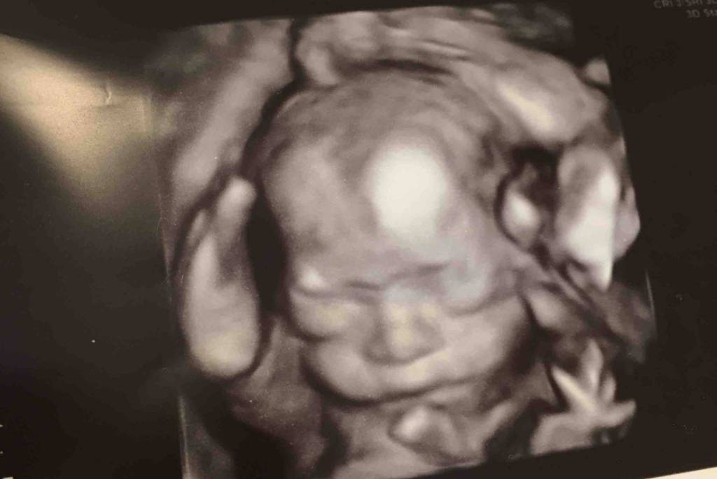 Above: One of Lorevie Rowe and John David&rsquo;s triplet boys, as seen in an ultrasound image. (Submitted photo)