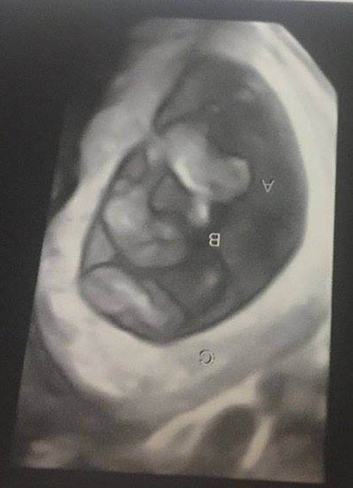 John David and Lorevie Rowe&rsquo;s triplets. (Submitted photo)