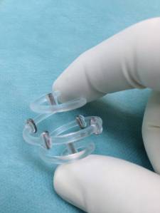 Photo courtesy of BioZorb Dr. Karen Barbosa, a Breast Fellowship-trained surgeon in Anchorage, has begun using BioZorb in lumpectomies. After a lump is removed, the surgeon inserts the device, a spiral the size of a walnut and six little titanium clips, that is implanted in the area where the lump was removed. It acts as a scaffold for reconstructive surgery and reduces the amount of radiation needed during treatment.