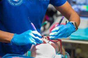 Opinion: The cost of unfluoridated water