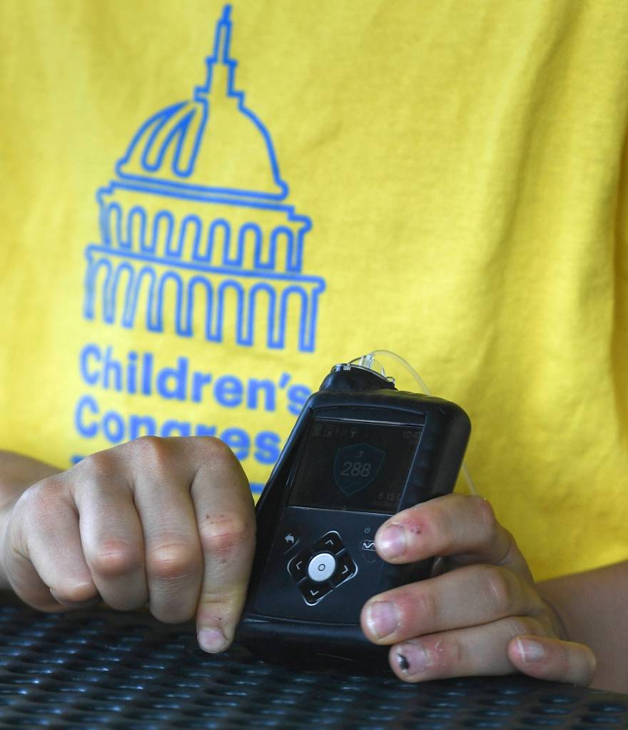 Bruno Malecha uses a continuous glucose monitoring system that works with an insulin pump to use real-time data to decide when to administer glucose and the size of the dose. It adjusts Brunos insulin based on his real-time glucose numbers instead of us constantly checking his blood sugar and deciding if we should give him more insulin, said his mom, Jen Malecha. (Michael Penn | Juneau Empire)