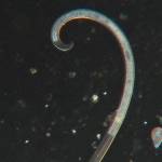 The story behind these ubiquitous round worms