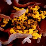 This undated electron microscope image made available by the U.S. National Institutes of Health in February 2020 shows the Novel Coronavirus SARS-CoV-2, yellow, emerging from the surface of cells, pink, cultured in the lab. Also known as 2019-nCoV, the virus causes COVID-19. The sample was isolated from a patient in the U.S. On Thursday, March 5, 2020, Tennessees Department of Health Commissioner Lisa Piercey confirmed the states first case of the new coronavirus. (NIAID-RML via AP)