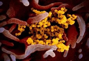 This undated electron microscope image made available by the U.S. National Institutes of Health in February 2020 shows the Novel Coronavirus SARS-CoV-2, yellow, emerging from the surface of cells, pink, cultured in the lab. Also known as 2019-nCoV, the virus causes COVID-19. The sample was isolated from a patient in the U.S. On Thursday, March 5, 2020, Tennessees Department of Health Commissioner Lisa Piercey confirmed the states first case of the new coronavirus. (NIAID-RML via AP)