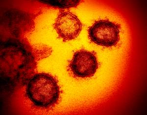 Twelfth case of COVID-19 confirmed in Juneau