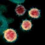 This undated electron microscope image made available by the U.S. National Institutes of Health in February 2020 shows the virus that causes COVID-19. The sample was isolated from a patient in the U.S. Some political leaders are hailing a potential breakthrough in the fight against COVID-19: simple pin-prick blood tests or nasal swabs that can determine within minutes if someone has, or previously had, the virus. But some scientists have challenged their accuracy. (NIAID-RML via AP)