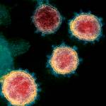 This undated electron microscope image made available by the U.S. National Institutes of Health in February 2020 shows the virus that causes COVID-19. The sample was isolated from a patient in the U.S. Some political leaders are hailing a potential breakthrough in the fight against COVID-19: simple pin-prick blood tests or nasal swabs that can determine within minutes if someone has, or previously had, the virus. But some scientists have challenged their accuracy. (NIAID-RML via AP)