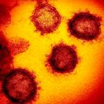 This undated electron microscope image made available by the U.S. National Institutes of Health in February 2020 shows the Novel Coronavirus SARS-CoV-2. Also known as 2019-nCoV, the virus causes COVID-19. The sample was isolated from a patient in the U.S. (NIAID-RML via AP)