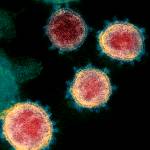 This undated electron microscope image made available by the U.S. National Institutes of Health in February 2020 shows the coronavirus that causes COVID-19. The sample was isolated from a patient in the U.S. (NIAID-RML via AP)