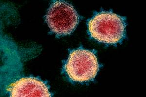 This undated electron microscope image made available by the U.S. National Institutes of Health in February 2020 shows the coronavirus that causes COVID-19. The sample was isolated from a patient in the U.S. (NIAID-RML via AP)