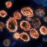 This 2020 electron microscope image provided by the National Institute of Allergy and Infectious Diseases - Rocky Mountain Laboratories shows SARS-CoV-2 virus particles which causes COVID-19, isolated from a patient in the U.S., emerging from the surface of cells cultured in a lab. (NIAID-RML via AP)