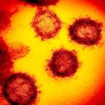 This transmission electron microscope image shows SARS-CoV-2, the virus that causes COVID-19, isolated from a patient in the U.S., emerging from the surface of cells cultured in the lab. (NIAID/TNS)