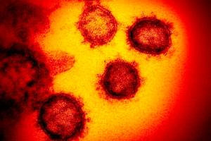 Electron microscope image of SARS-CoV-2, the virus that causes COVID-19, released by the U.S. National Institutes of Health in February 2020. (Associated Press)