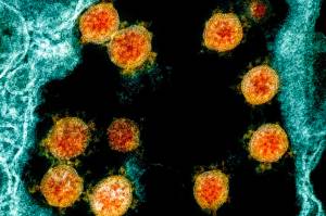 This electron microscope image made available and color-enhanced by the National Institute of Allergy and Infectious Diseases Integrated Research Facility in Fort Detrick, Md., in 2020, shows Novel Coronavirus SARS-CoV-2 virus particles, orange, isolated from a patient. (NIAID/National Institutes of Health)