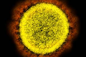 This 2020 electron microscope image made available by the National Institute of Allergy and Infectious Diseases shows a Novel Coronavirus SARS-CoV-2 particle isolated from a patient, in a laboratory in Fort Detrick, Md. Coronaviruses, including the newest one, are named for the spikes that cover their outer surface like a crown, or corona in Latin. Using those club-shaped spikes, the virus latches on to the outer wall of a human cell, invades it and replicates, creating viruses to hijack more cells. (NIAID / NIH)
