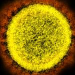 This 2020 electron microscope image made available by the National Institute of Allergy and Infectious Diseases shows a Novel Coronavirus SARS-CoV-2 particle isolated from a patient, in a laboratory in Fort Detrick, Md. Coronaviruses, including the newest one, are named for the spikes that cover their outer surface like a crown, or corona in Latin. Using those club-shaped spikes, the virus latches on to the outer wall of a human cell, invades it and replicates, creating viruses to hijack more cells. (NIAID / NIH)