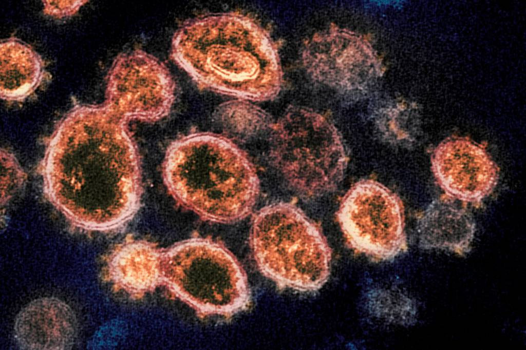 This 2020 electron microscope image provided by the National Institute of Allergy and Infectious Diseases - Rocky Mountain Laboratories shows SARS-CoV-2 virus particles which causes COVID-19, isolated from a patient in the U.S., emerging from the surface of cells cultured in a lab. On Monday, Oct. 5, 2020, the top U.S. public health agency said that coronavirus can spread greater distances through the air than 6 feet, particularly in poorly ventilated and enclosed spaces. But agency officials continued to say such spread is uncommon, and current social distancing guidelines still make sense. (NIAID-RML via AP)