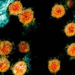 This electron microscope image made available and color-enhanced by the National Institute of Allergy and Infectious Diseases Integrated Research Facility in Fort Detrick, Md., shows Novel Coronavirus SARS-CoV-2 virus particles, orange, isolated from a patient.	(THE CANADIAN PRESS/AP-NIAID/National Institutes of Health)