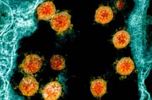 This electron microscope image made available and color-enhanced by the National Institute of Allergy and Infectious Diseases Integrated Research Facility in Fort Detrick, Md., shows Novel Coronavirus SARS-CoV-2 virus particles, orange, isolated from a patient.	(THE CANADIAN PRESS/AP-NIAID/National Institutes of Health)